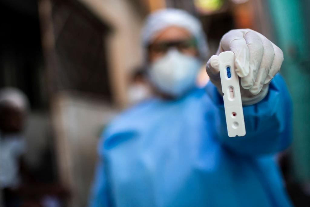 3set2020---agente-de-saude-segura-teste-com-resultado-positivo-para-o-novo-coronavirus-durante-testagem-na-favela-da-mangueira-no-rio-de-janeiro-1600200520286_v2_1024x683