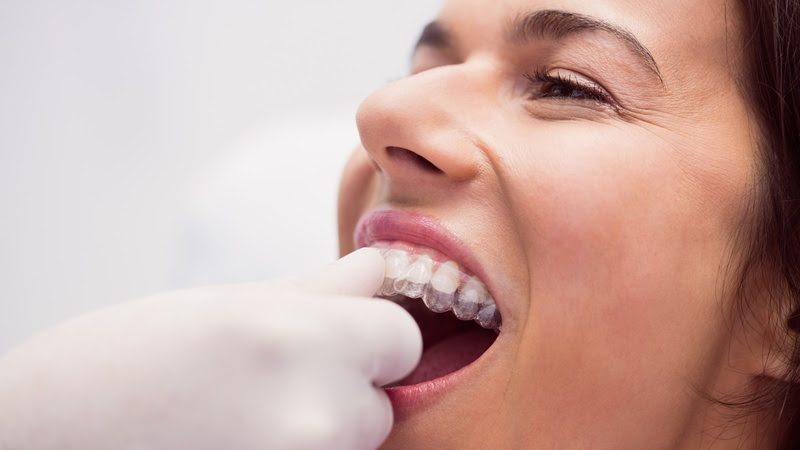 Dentist assisting female patient to wear braces
